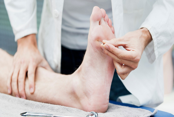 Diabetic Neuropathy